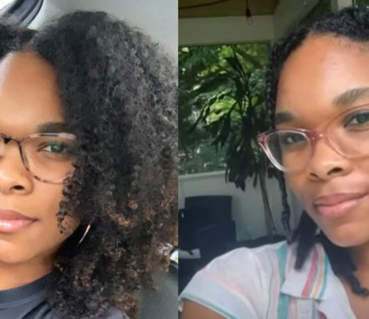 Black Woman Woke Up from Surgery with Her Hair Perfectly Braided: Her Surgeon Did It Before and after hair braided