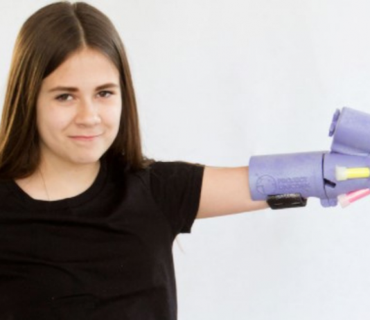 No Big Deal, Just a Prosthetic Arm That Shoots Glitter Invented By a Young Woman