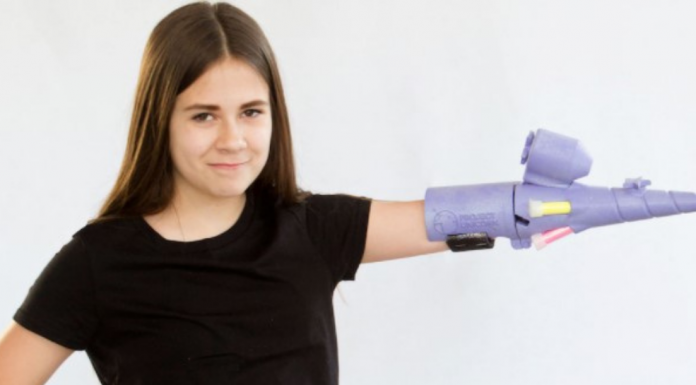 No Big Deal, Just a Prosthetic Arm That Shoots Glitter Invented By a Young Woman